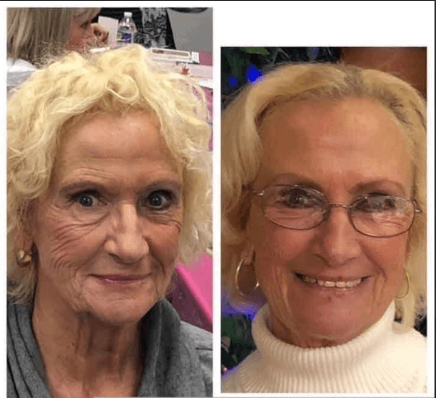 Donna — before and after
